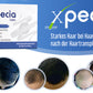 Xpecia gegen Haarverlust bei Männern