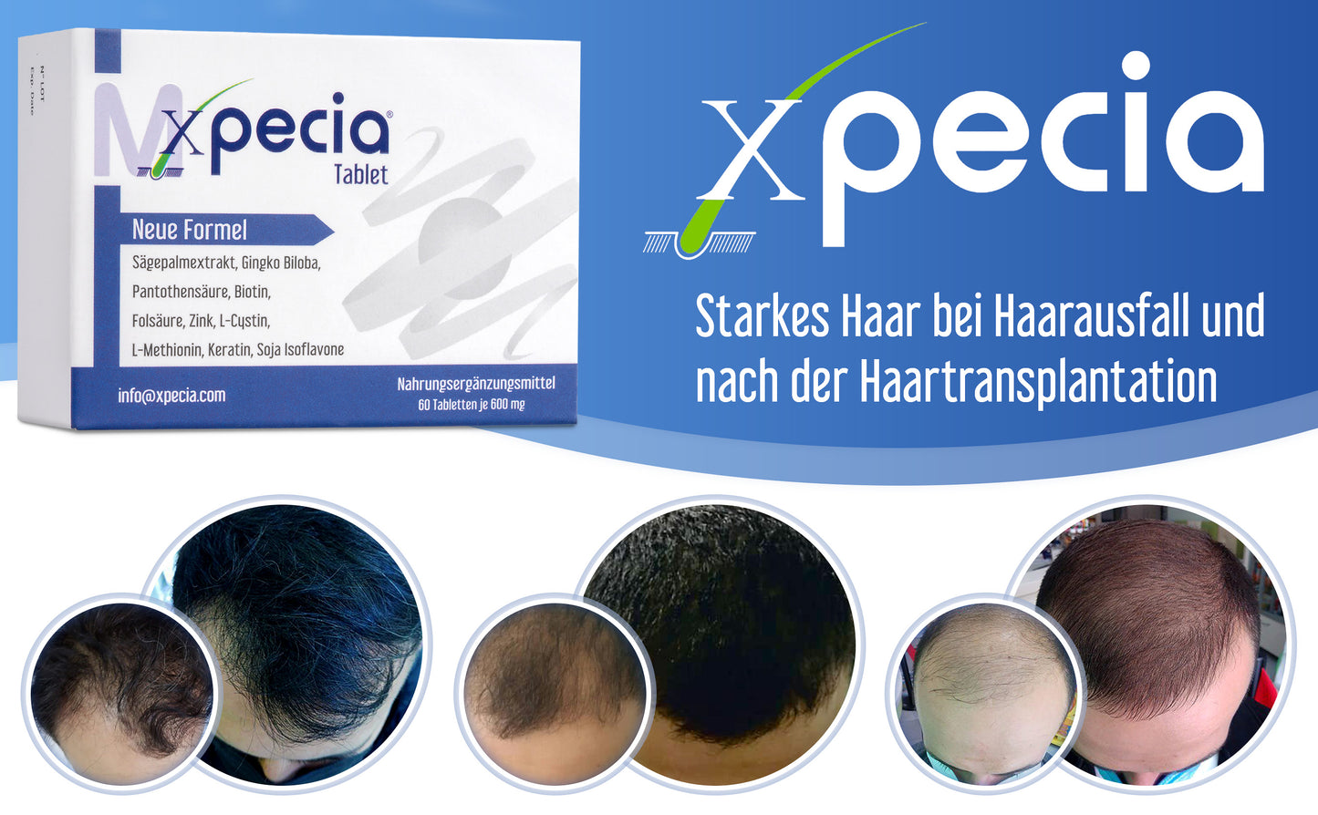 Xpecia gegen Haarverlust bei Männern